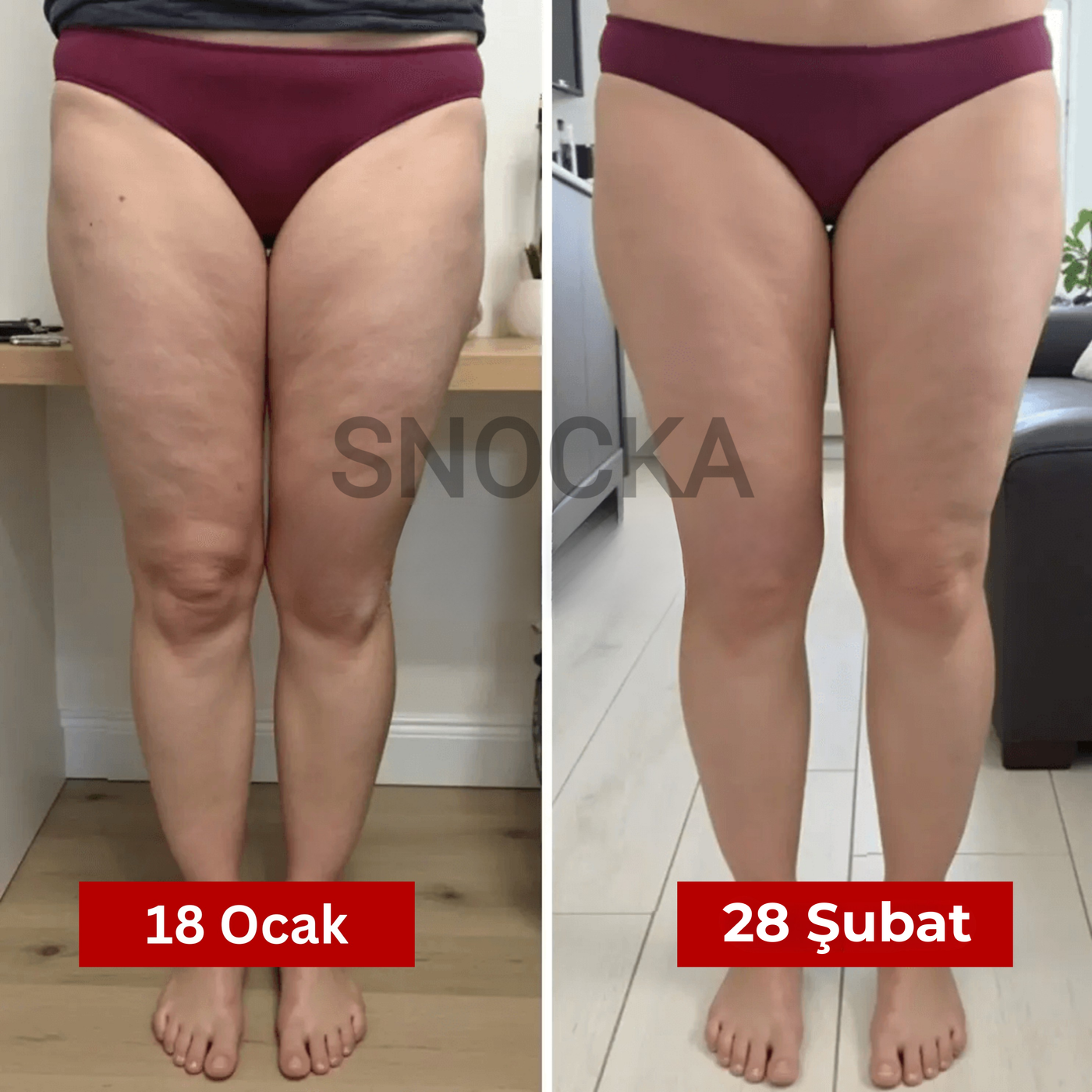 Snocka Premium Şekillendirici - Selülit Giderici Tayt